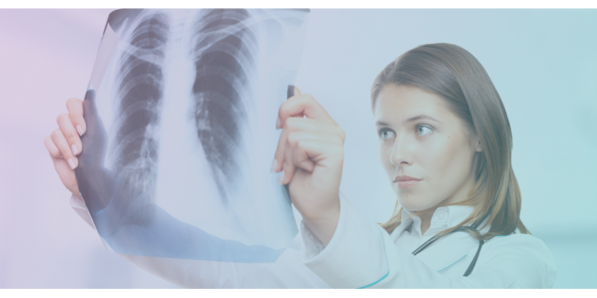 Quais são os tratamentos para o câncer de pulmão? 
