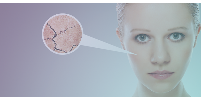 Saiba quais são os efeitos da radioterapia na pele