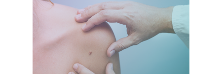 Conheça as formas de tratar o câncer de pele e quais precauções devem ser tomadas durante tratamento